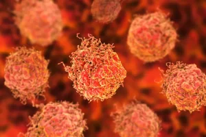 استراتيجية علاجية جديدة لمرضى سرطان البروستاتا